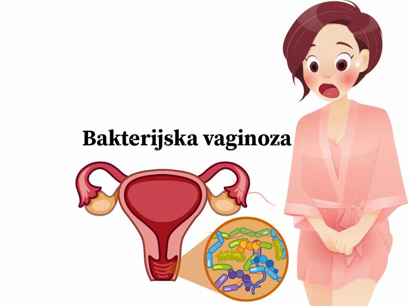 Pročitajte više o članku Bakterijska vaginoza