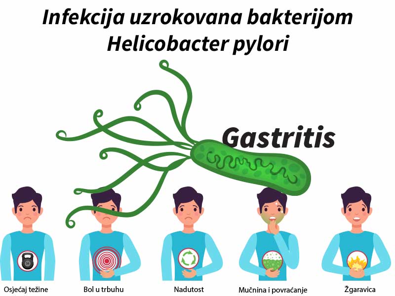 Pročitajte više o članku Helicobacter pylori – infekcija uzrokovana bakterijom H. pylori